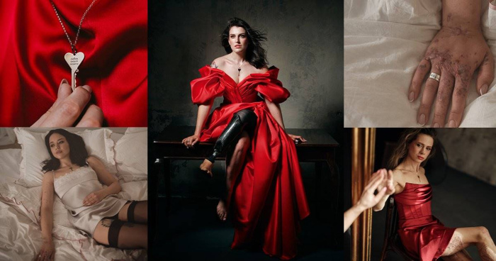 Агенція Adsapience та ПУМБ представили фотопроєкт «Краса зі шрамом» для журналу PLAYBOY