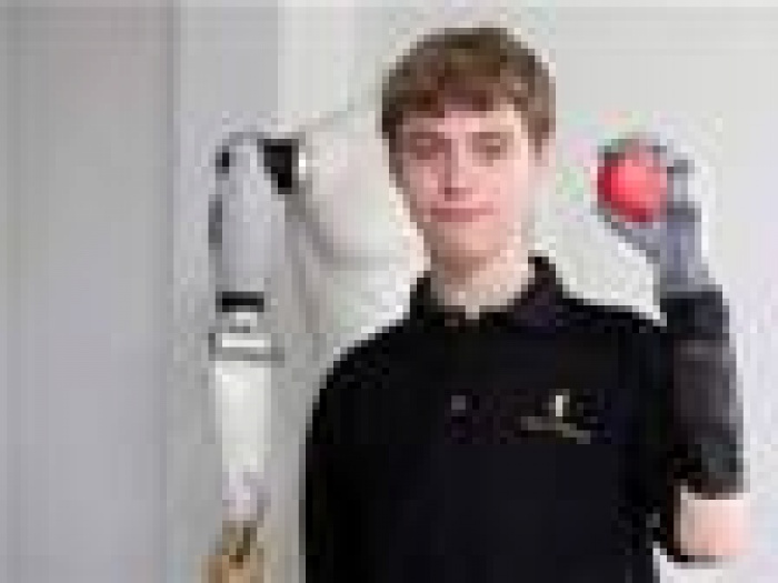 Мальчик предложил Mercedes рекламу в обмен на протез руки